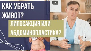 КАК УБРАТЬ ЖИВОТ? ЛИПОСАКЦИЯ ИЛИ АБДОМИНОПЛАСТИКА?