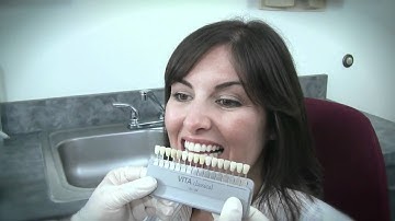 VITA Easyshade Compact Features and Benefits Video