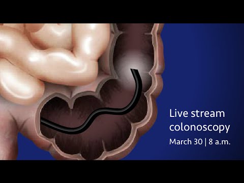 Preparing for aPreparing for acolonoscopyPreparing for aPreparing for acolonoscopy? Watch to learn w. Preparing for aPreparing for acolonoscopyPreparing for aPreparing for acolonoscopy? Watch to learn w.