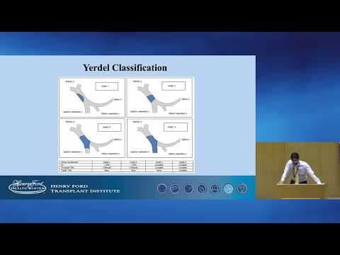 The Impact of Portal Vein Thrombosis Grade and Post-Reperfusion Flow Rate in Liver Transplants