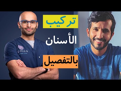 فيديو: هل المفاجئة على الضمان مدى الحياة؟