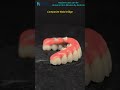 composite Malo bridge with zirconia crowns.#dental #dentalprosthesis #china