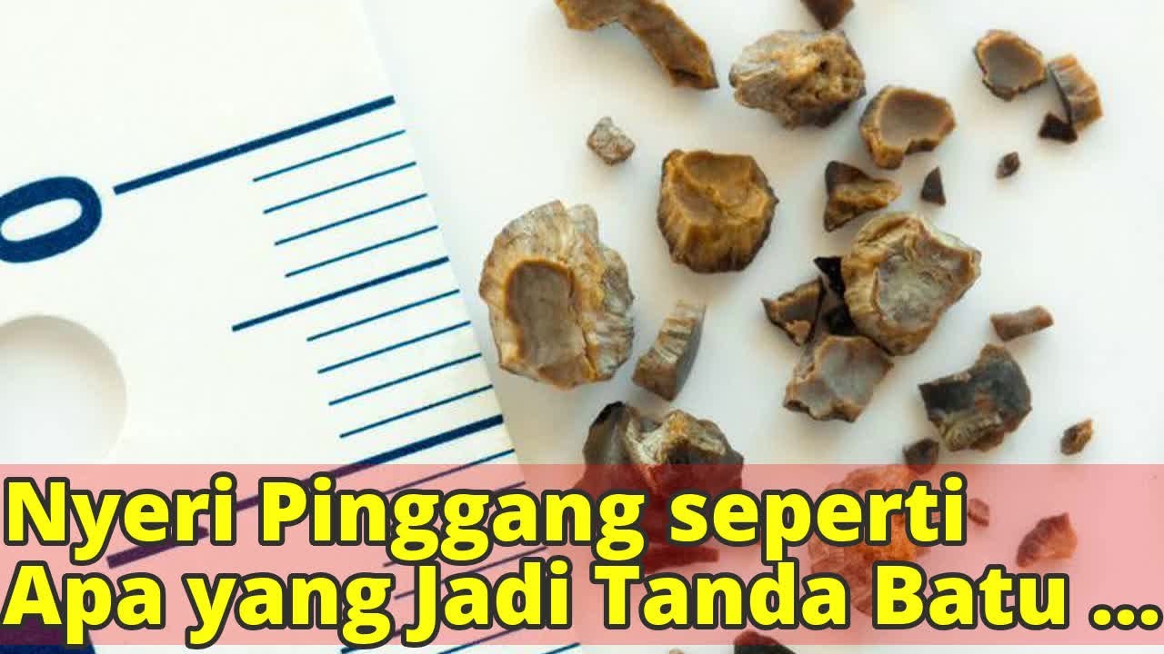 Keputihan Yang Wajar Sebagai Tanda Hamil Seperti Apa Keputihan Yang Wajar Sebagai Tanda Hamil Seperti Apa