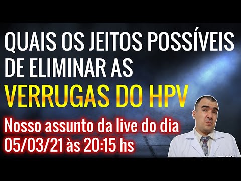 Vídeo: Alguns Aspectos Da Possível Terapia Para Verrugas Genitais. Gakh D.V