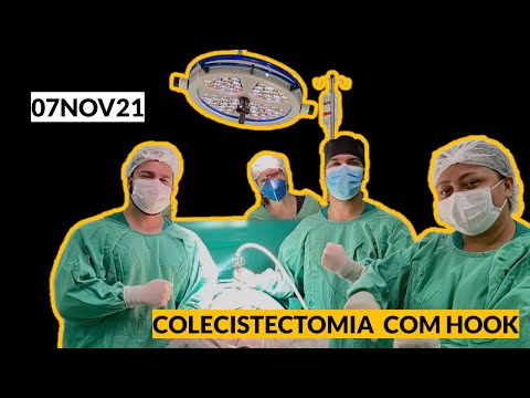 Ooforectomia • Oophorectomy - DR. LUCAS DUARTE [OUT21] 