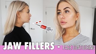 JAW FILLERS | jaws, cheekbone, smile lines and under eye filler | Flawless cosmetics