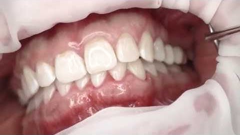 Integrated implantology: The digital workflow.