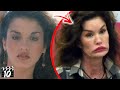 Top 10 Celebrities You Won't Recognize After Plastic Surgery  - Part 4