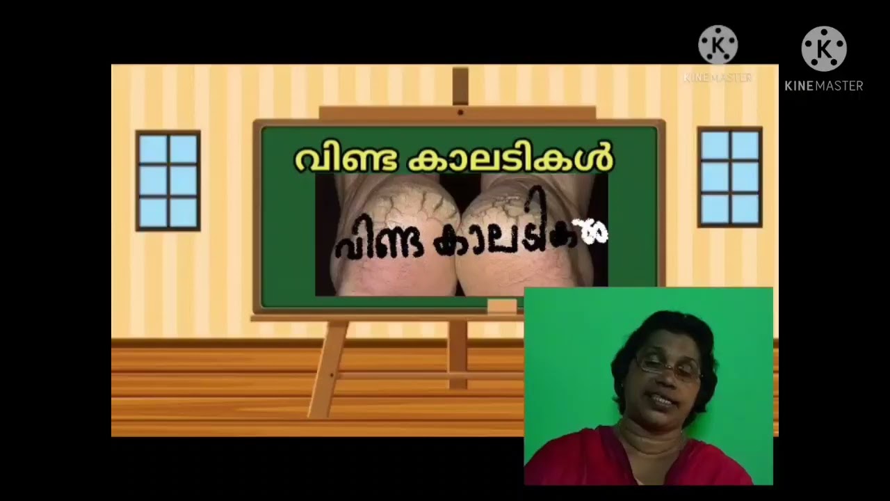 വിണ്ട കാലടികൾ :- പി. ഭാസ്കരൻ (ഭാഗം 1)