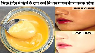 1DAY SKIN WHITENING CHALLENGE|GLOW FACIAL-1बार ये facial कर लो इतना ग्लो आएगा की पार्लर भूल जाओगे|