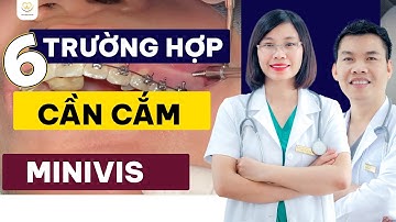Trường Hợp Nào Thì Cần Cắm Minivis Trong Niềng Răng | Bác sĩ Trung Long Biên