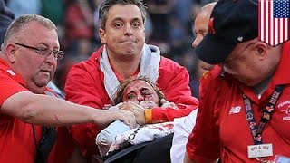 Woman hit by broken bat at Fenway Park upgraded to fair from serious condition - TomoNews