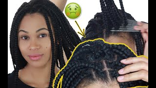 HOW TO CLEAN BOX BRAIDS | REMOVE ALL DANDRUFF &amp; BUILD-UP