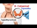 8 Calaamad Xanuunka Thyroid Nooca Dhacsan Hypothyroidism Ma Isku Aragtay 8 Calaamad Xanuunka Thyroid Nooca Dhacsan Hypothyroidism Ma Isku Aragtay