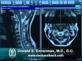 How to Read a MRI of the Normal Cervical Spine (Neck) | Colorado Spine Expert