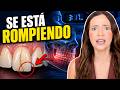 Despiertas Con Dolor De Mandíbula? Tus DIENTES Podrían Estar Rompiéndose De Noche