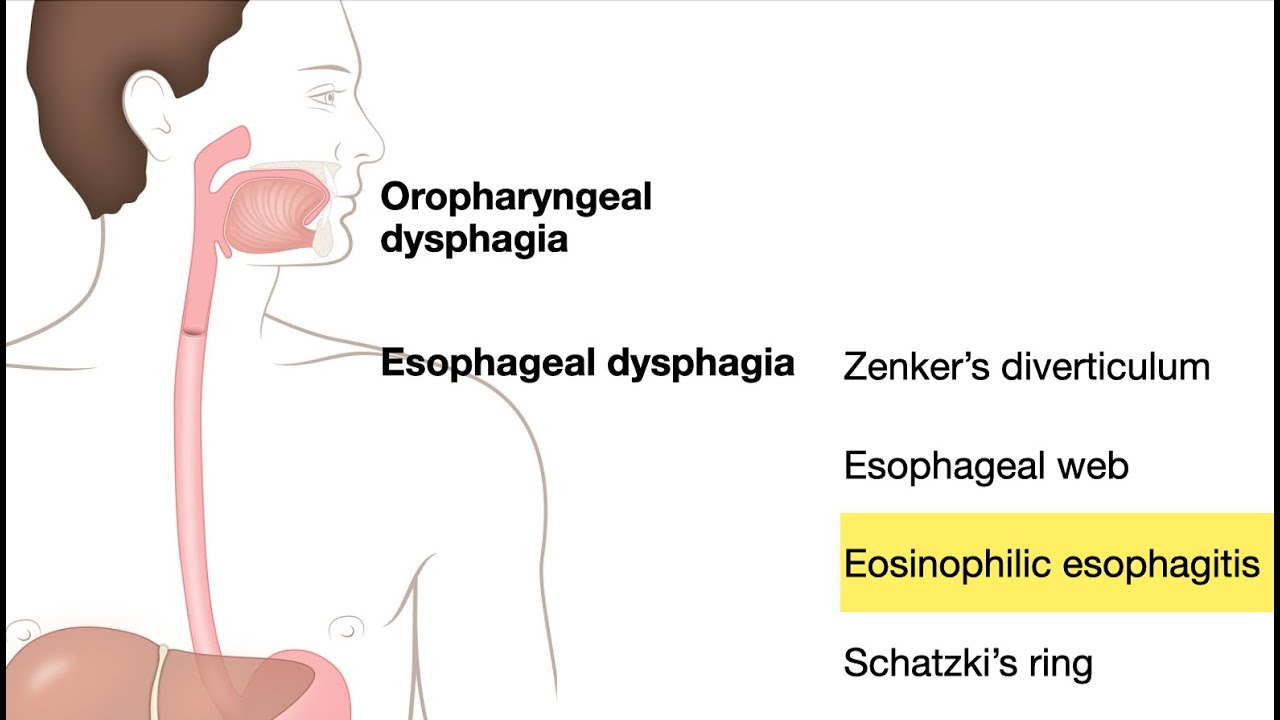 Esophagus (Human Anatomy): Picture, Function, Diseases, Tests, and  Treatments