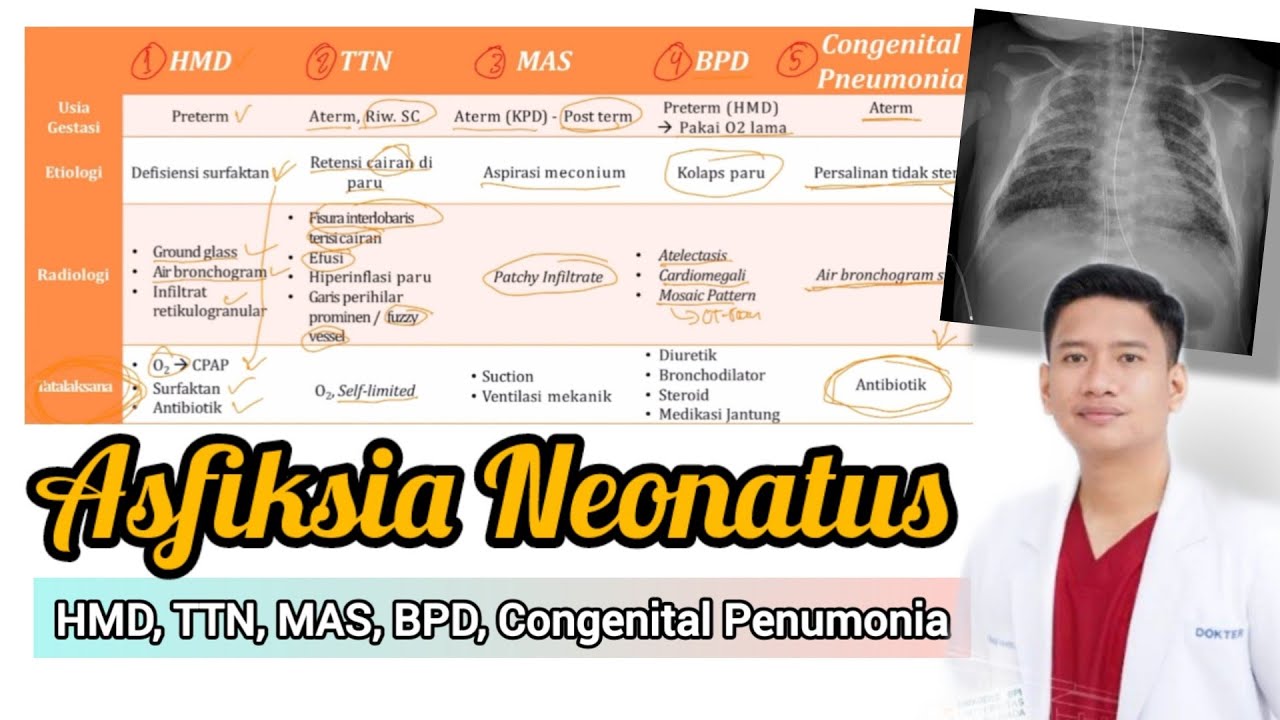 Asfixia Neonatus (Sesak Napas pada Bayi Baru Lahir)