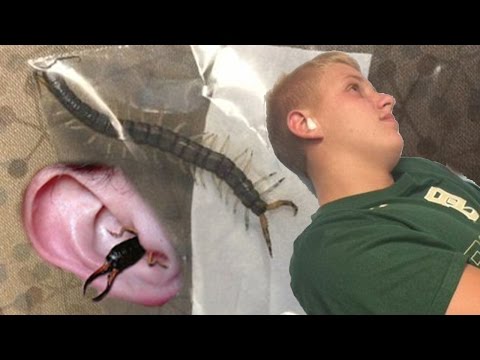 Teen Pulls Out 4 Inch Centipede From His Ear