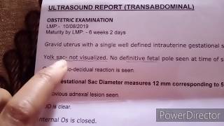 5 weeks pregnancy ultrasound report KAISE read kre//jab heart beat ni aayi thi to???