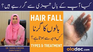 Balon Ka Girna Kaise Band Kare - Hair Loss Types & Treatment - Hair Fall Solution At Home
