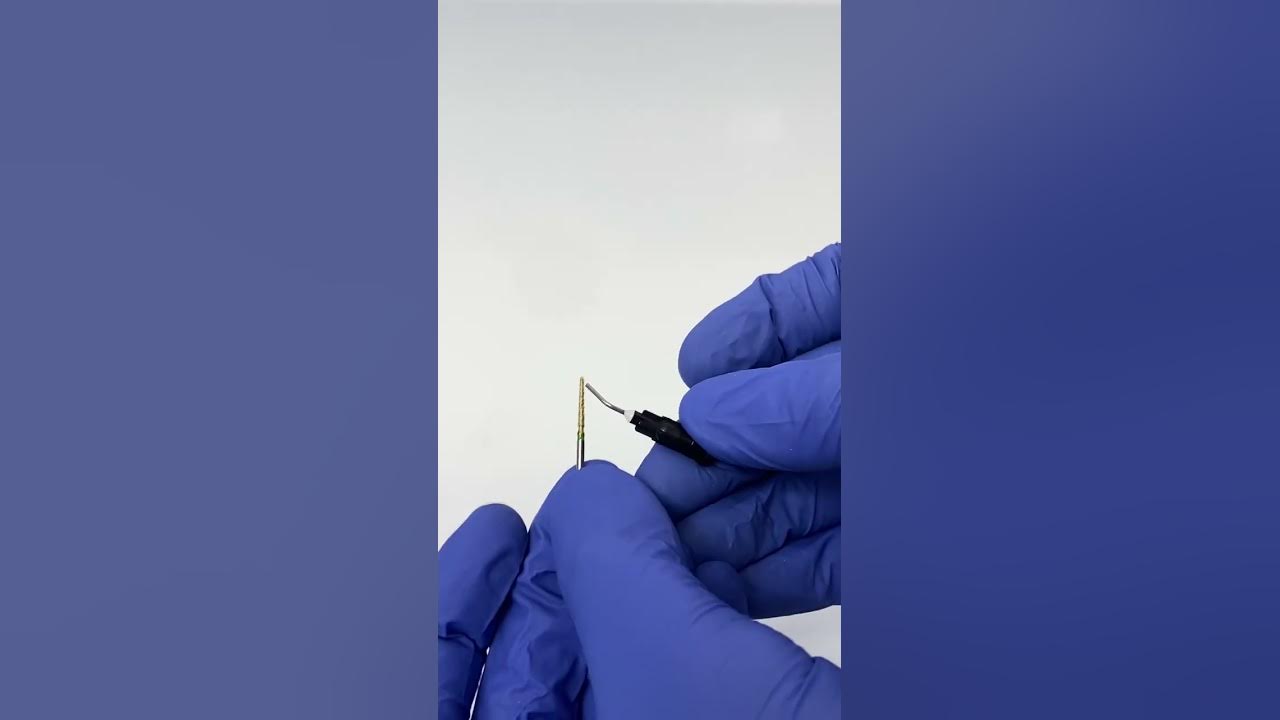 Modified Tube Technique for Broken File Removal Advanced Endodontics