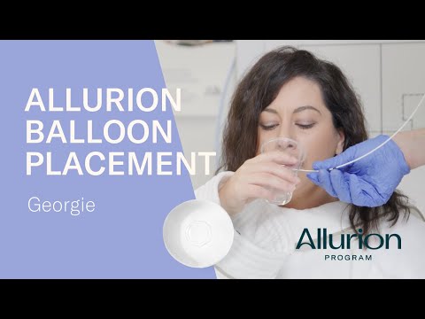 Georgie's Allurion Gastric Balloon Placement
