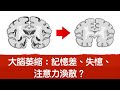 大腦萎縮嗎？記憶差,注意力渙散,再生腦細胞有方法,自然療法,柏格醫生Dr berg