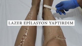 LAZER EPİLASYON ACITIYOR MU? UYGULAMALI ANLATIM