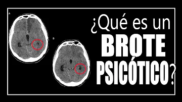 ¿Qué le ocurre al cerebro durante un brote psicótico?