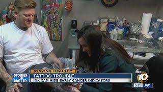 Tattoos can hide early skin cancer indicators