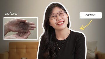 Sau Nhiều Năm Rụng Tóc - Đây Là Những Điều Mình Nhận Ra