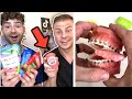 Dental Digests Favorite Snacks VS Braces