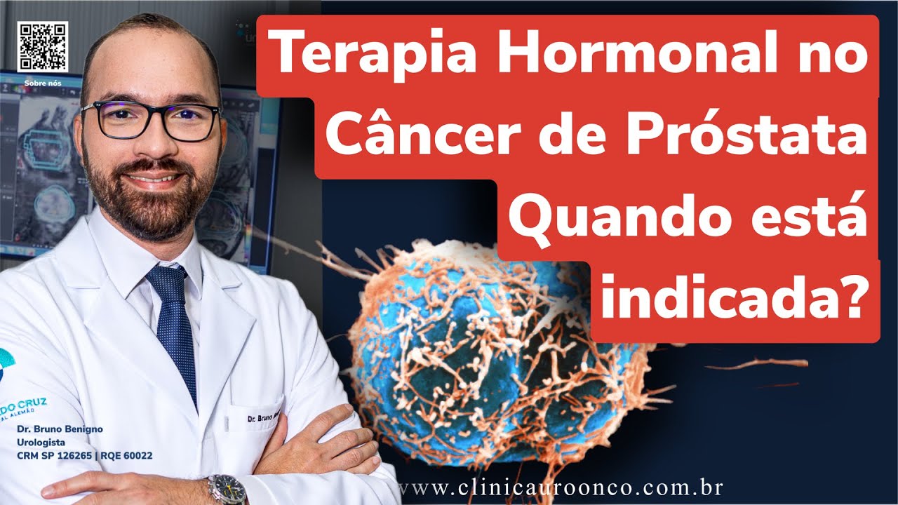 Bloqueio de Testosterona para Câncer de Próstata: Mitos e Verdades ...