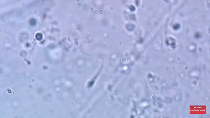 Human  spermatozoons.