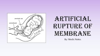 Celebrity [Houseman preparation procedures] Artificial rupture of membrane - procedural steps Net Worth