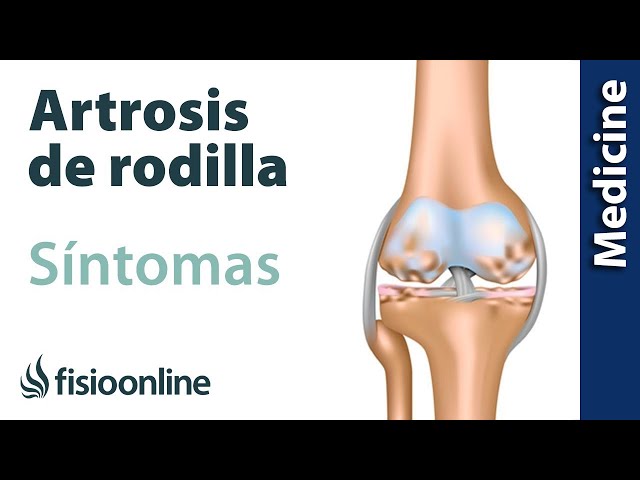 Precio operacion rodilla artrosis