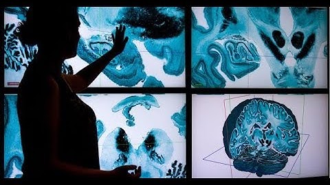 The BigBrain Atlas - the highest-resolution, 3D digital model of the human brain produced to date