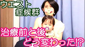 動画 点 頭 てんかん