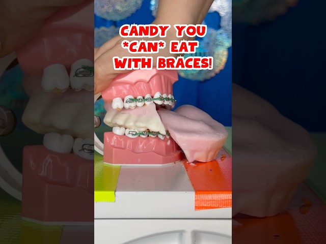 Avoid These: Worst Candy for Halloween 3 sddefault