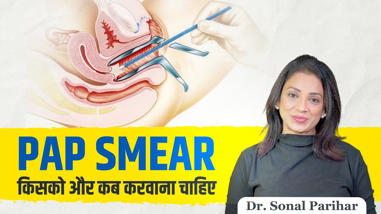 Pap Smear: किसको और कब करवाना चाहिए? Pap Smear: इसे कब और क्यों कराना चाहिए?