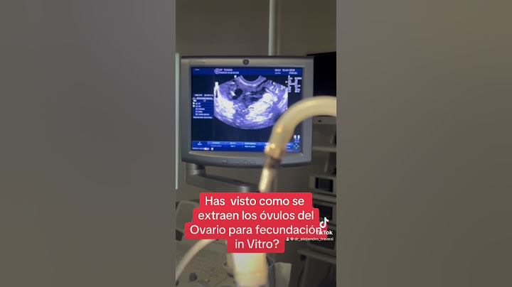 Fecundación In vitro #embarazo #fiv #infertilitycauses #doctor #invitro #infertilidad