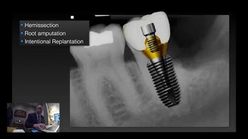 Alex Fleury Podcast 1: Mission Saving Teeth