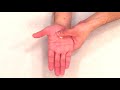 Hd 2 Hand Scar Massage MFT