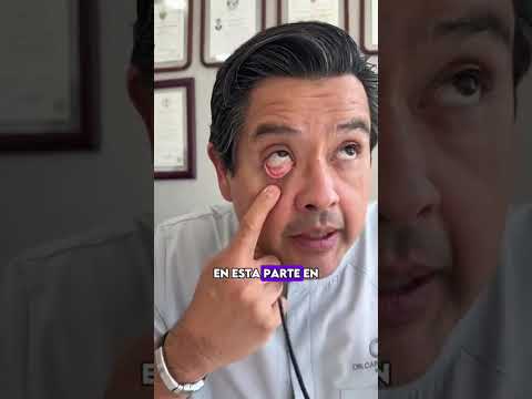 Ese cansancio, falta de hambre, falta de capacidad física, es por anemia, ¿no lo sabías? #anemia