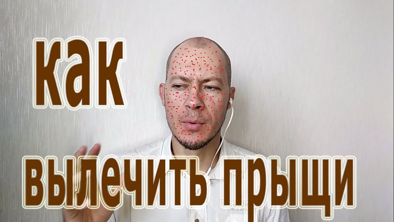 Как вылечить прыщи Почему вскакивают Что делать, если вскочил прыщ ...