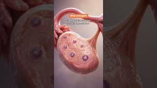 Multiple Fails IUIs &amp; IVFs #draradhyaachuri #fertilityjourney #ivf #ivfsuccess #iuisuccess