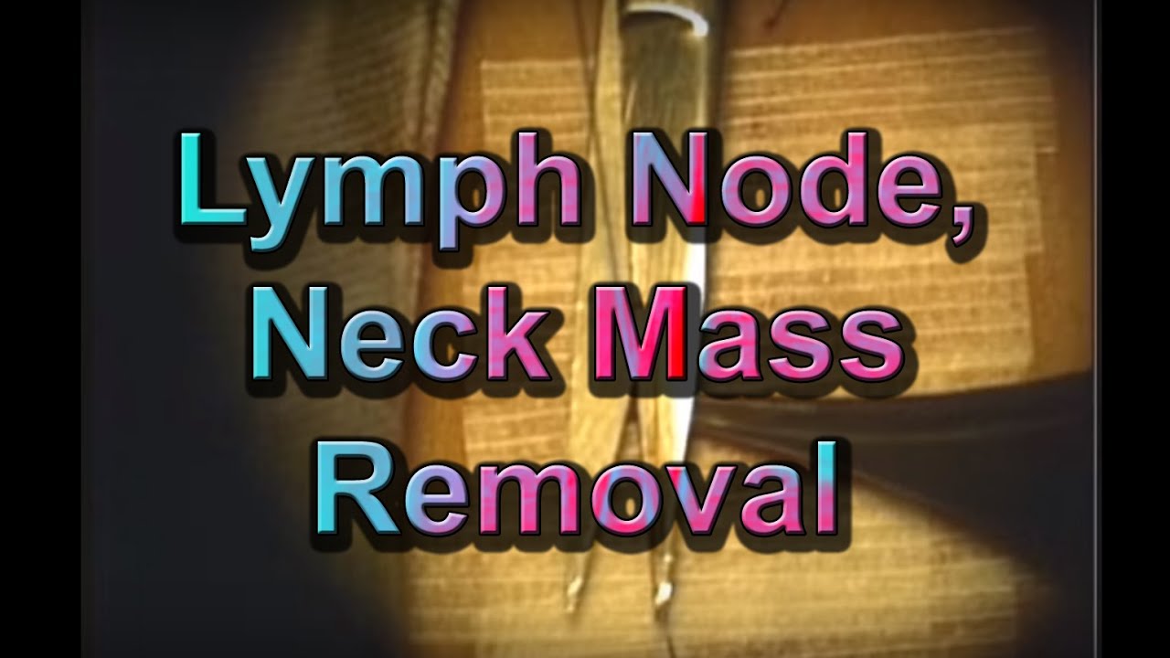 How to safely remove a neck mass, lymph node YouTube