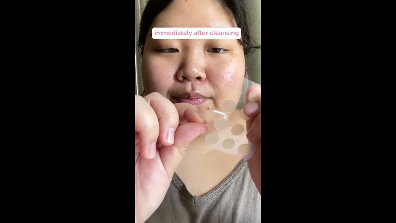 How To Use A Pimple Patch FaceTory
