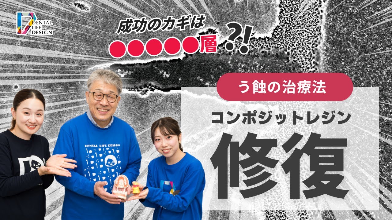 う蝕の治療法 CR修復について教えてください】歯科衛生士さんのための